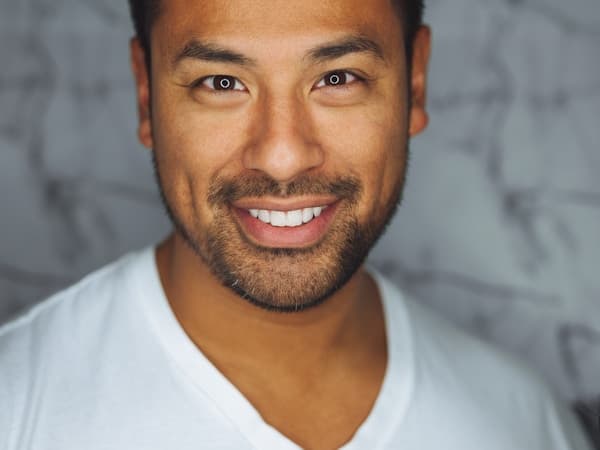 Tratamiento Anti-edad - Después