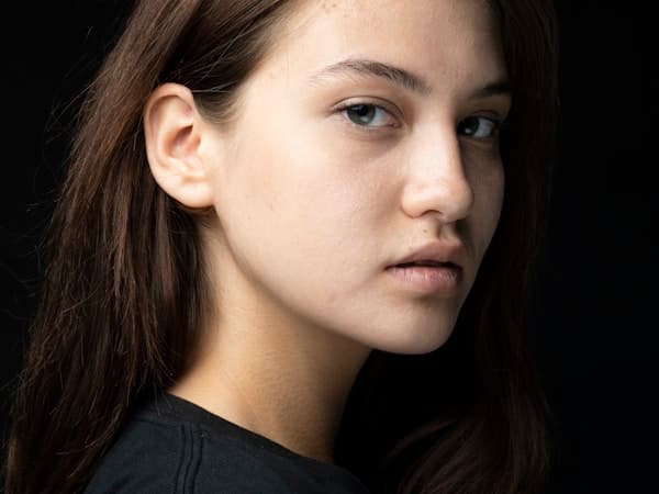 Eliminación de Manchas - Después